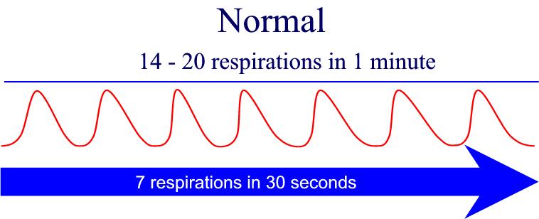 Adult Respiratory Rate 107