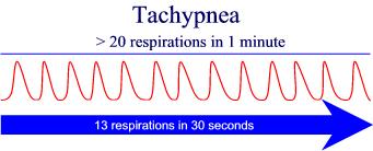 Normal Adult Breathing Rate 115