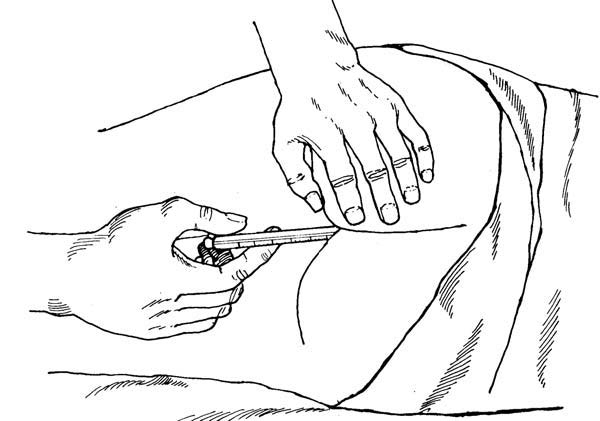 Anal Insertion Rectal Temperature - Insert a thermometer into the anus - Adult archive