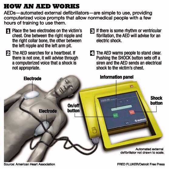 8 1 Indications For Early Defibrillation 