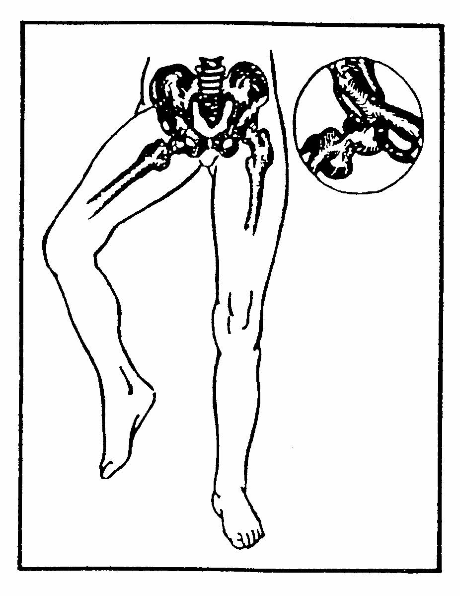 Anterior Femur