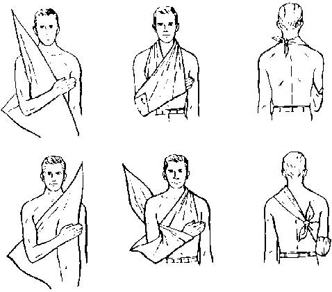 how to do a sling