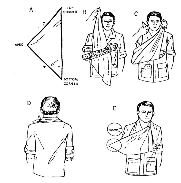 5-8. APPLY A SLING TO AN ARM