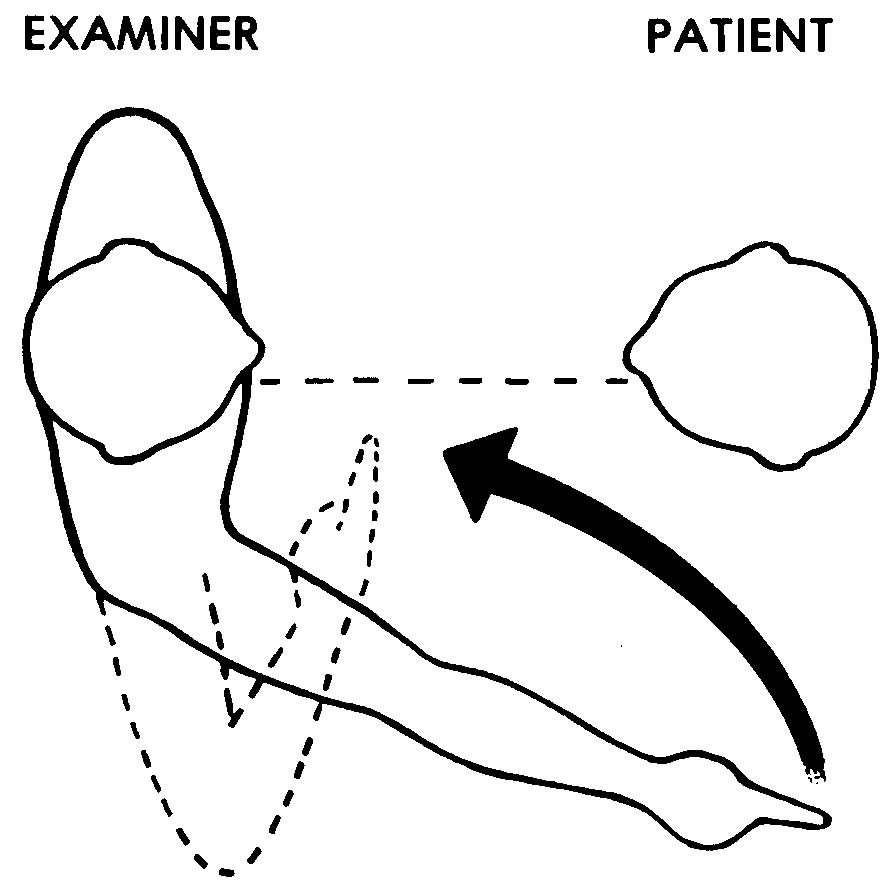 1-7. EXAMINATION OF THE EYE